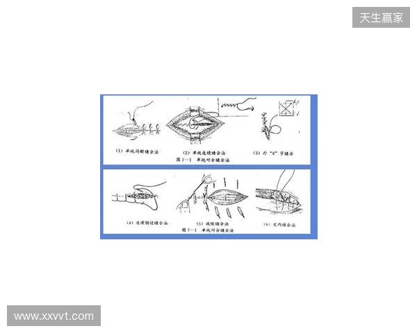 广州豹官方:杨浩眉弓伤口缝合30余针,预计5-7天后拆线 广州豹官方:杨浩眉弓伤口缝合30余针,预计5-7天后拆线